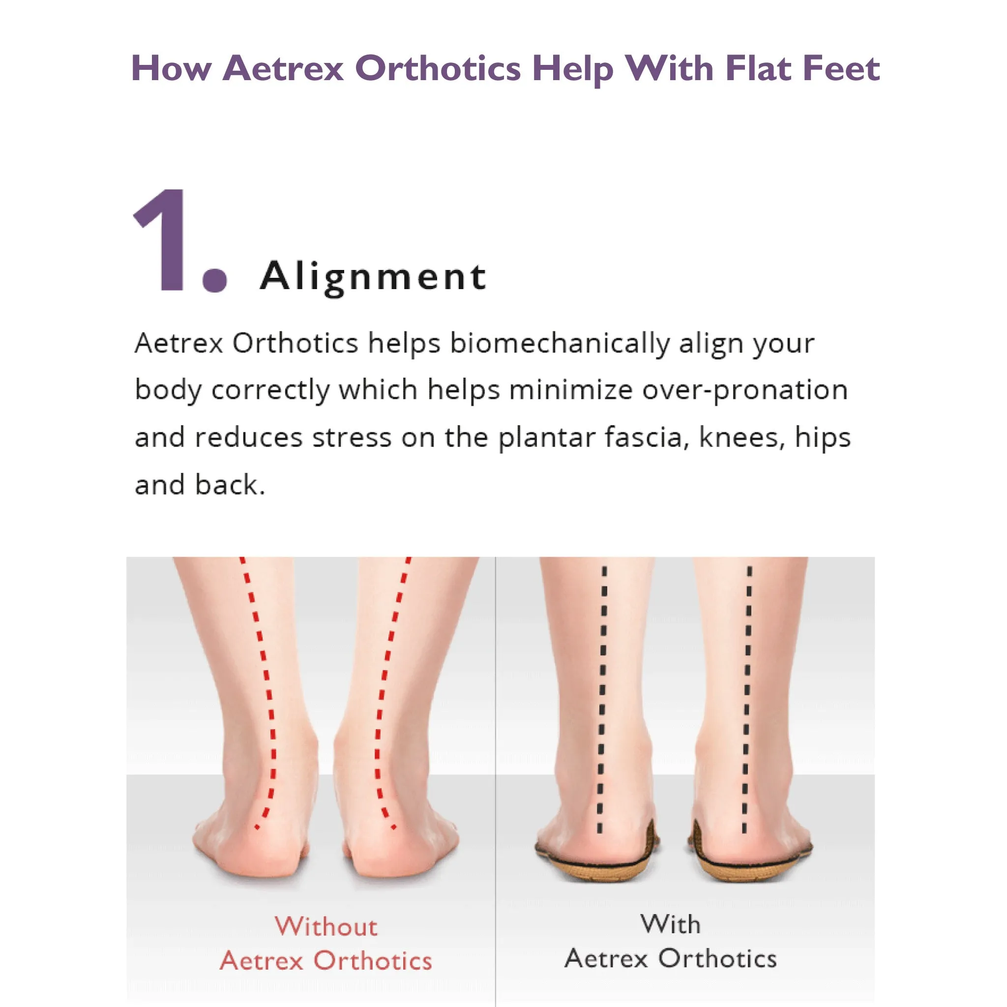 Aetrex | Women's Active Orthotics L1925W (Flat/Low Arch) with Metatarsal Support